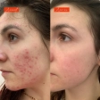 Huile Lundi matin - Actif anti imperfections - Cahé
