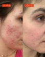 Huile Lundi matin - Actif anti imperfections - Cahé